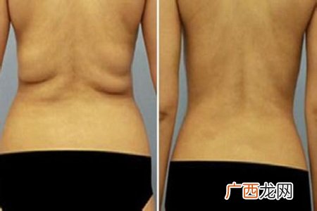 专家教你四招快速减去腰部多余赘肉