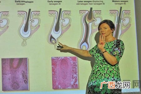 女性掉头发很厉害是什么原因？掉头发怎么办？