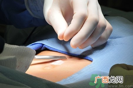 女性体虚怕冷怎么调理?女性体虚吃什么好