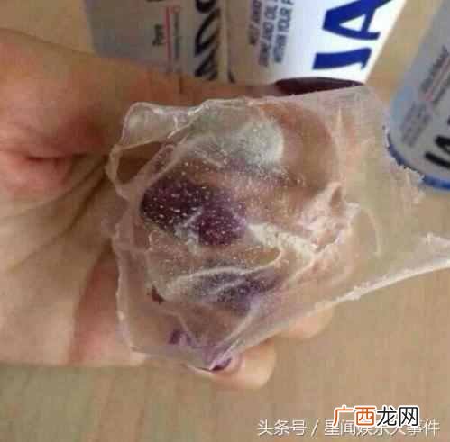 螨虫挤出来是什么样子？脸上有螨虫的症状图片