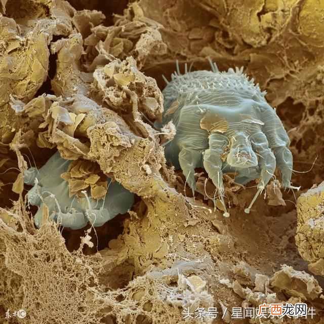 螨虫挤出来是什么样子？脸上有螨虫的症状图片