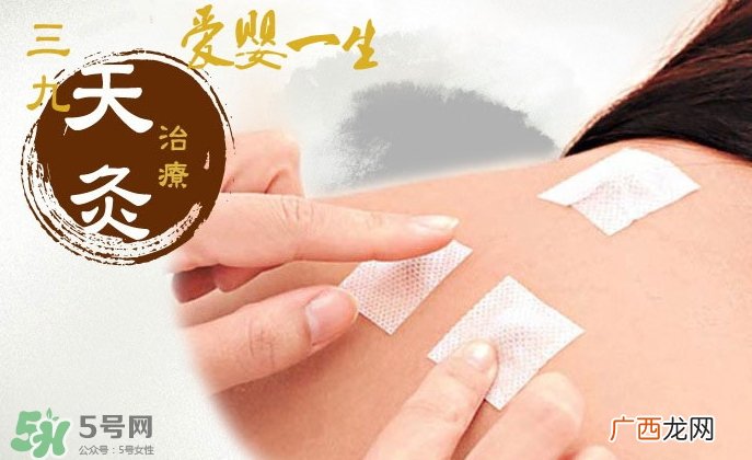 三伏贴和三九贴的区别三伏贴和三九贴的作用
