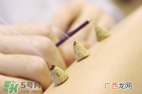三伏贴和三伏灸哪个效果好?三伏贴和三伏灸对比