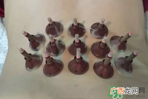 艾艾贴可以贴肚脐眼吗？艾艾贴贴肚脐有什么作用？