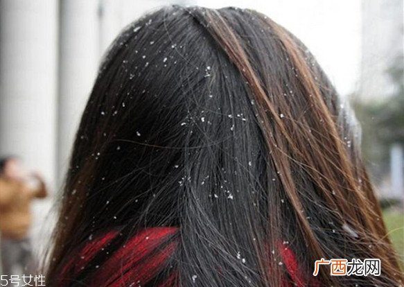 洗了头发不吹干好吗头发不吹干睡觉的危害