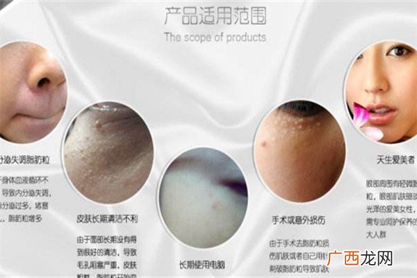啤酒可以去除脂肪粒吗脂肪粒去除方法