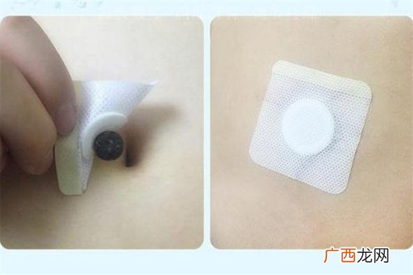 南怀瑾肚脐贴多少钱南怀瑾肚脐贴在哪里能买到