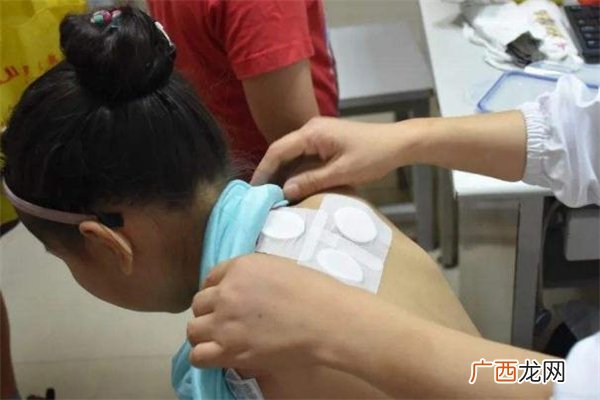 三伏贴能治肩周炎吗三伏贴能治腰肌劳损吗