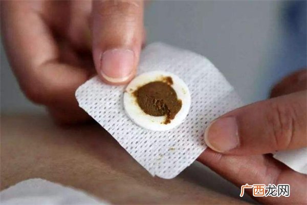 三伏贴为什么会发热三伏贴能治老寒腿吗