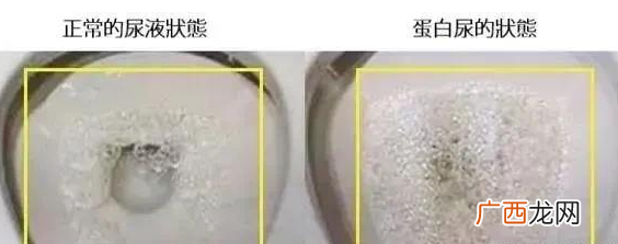 肾不好的人有什么表现人肾不好身体有什么反应