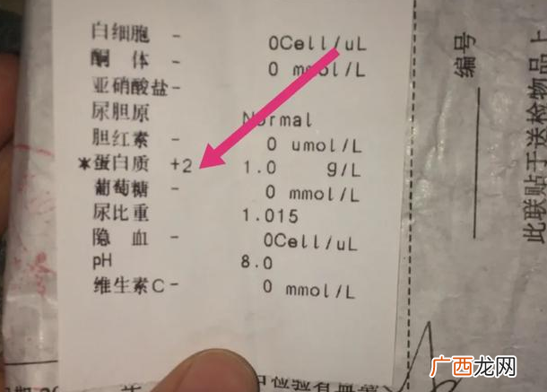肾不好的人有什么表现人肾不好身体有什么反应