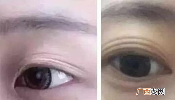 肾不好的人有什么表现人肾不好身体有什么反应