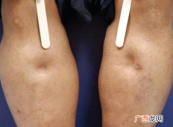 肾不好的人有什么表现人肾不好身体有什么反应