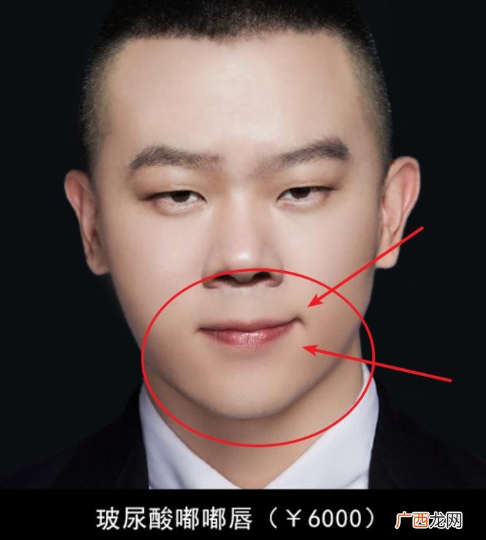 邓伦是不是开了眼角，确定不是邓伦