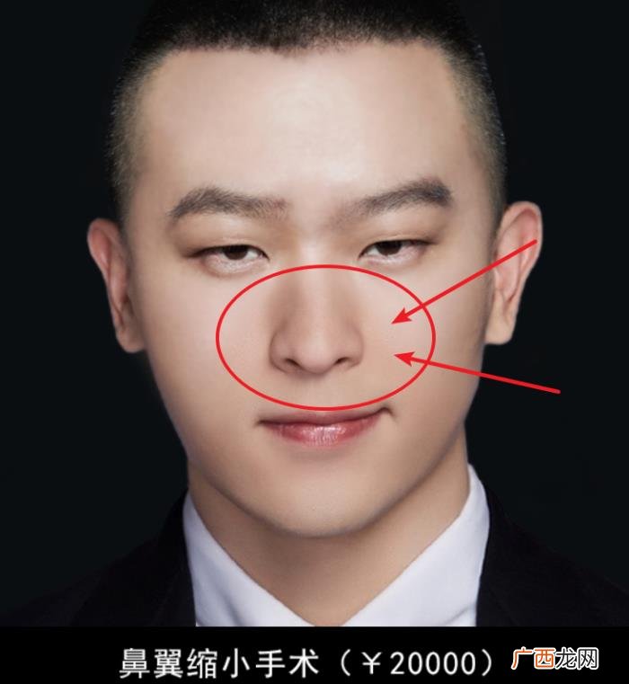 邓伦是不是开了眼角，确定不是邓伦