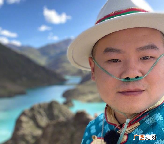 邓伦是不是开了眼角，确定不是邓伦