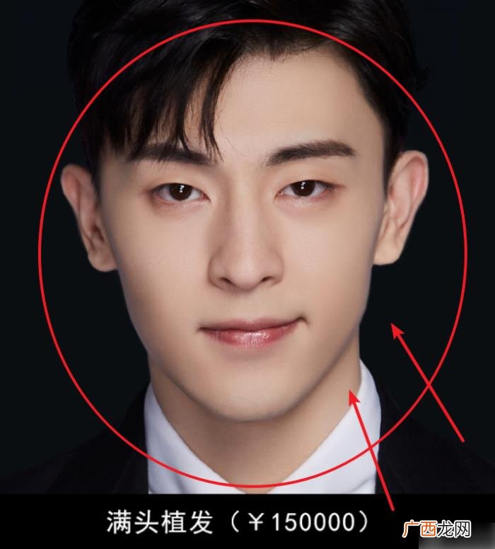 邓伦是不是开了眼角，确定不是邓伦