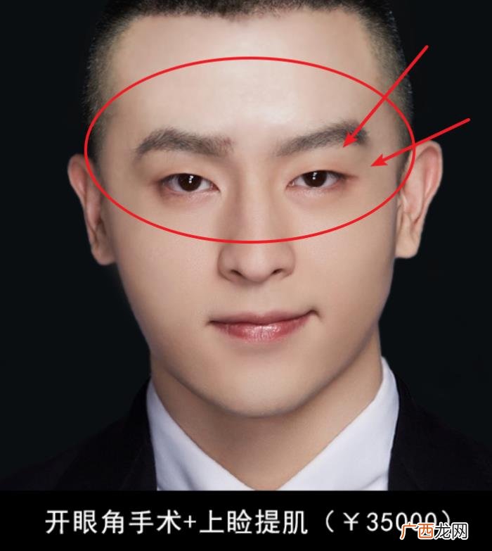 邓伦是不是开了眼角，确定不是邓伦