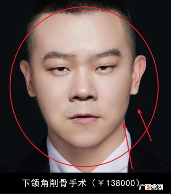 邓伦是不是开了眼角，确定不是邓伦