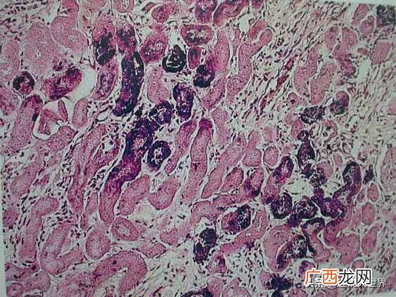 人为什么要吃盐而动物不用(这7种人必须少吃盐