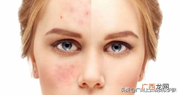 修复皮肤屏障是什么意思(皮肤科医生告诉你如
