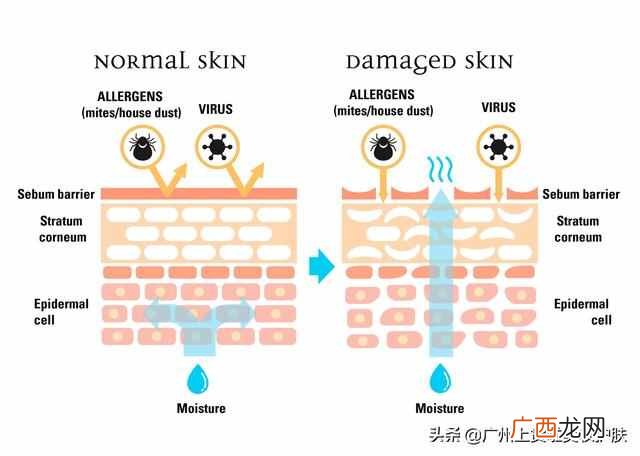 修复皮肤屏障是什么意思(皮肤科医生告诉你如