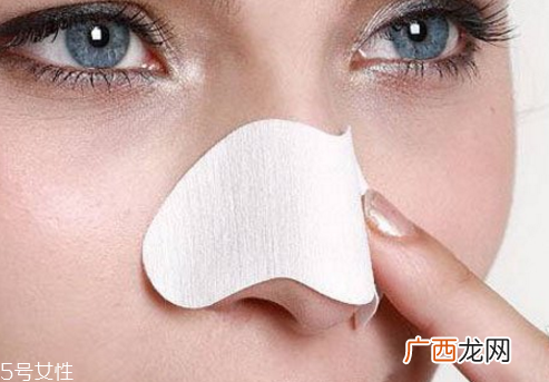 黑头贴可以天天用吗 不宜过多使用