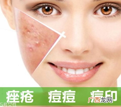 a酸怎么用？a酸怎么建立耐受？