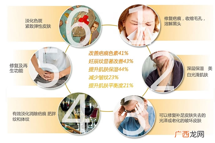 swisse玫瑰果油好用吗 有助改善疤痕和妊娠纹
