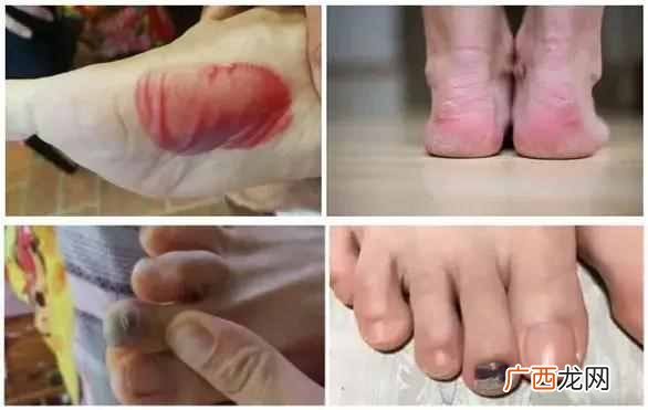 男士跑步适合穿什么袜子（贝克汉、余文乐都这