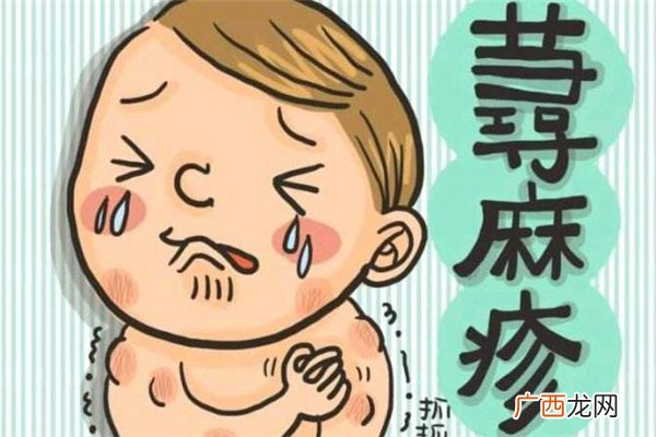 冬季荨麻疹易发作原因该如何治疗