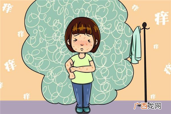 冬季荨麻疹易发作原因该如何治疗