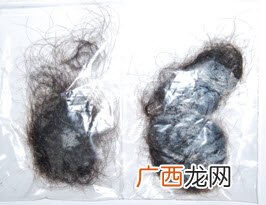休止期脱发怎么办什么是休止期脱发