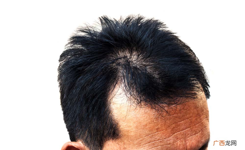 掉头发很厉害是什么原因
