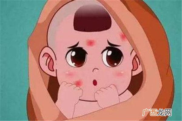 什么是玫瑰糠疹如何鉴定玫瑰糠疹