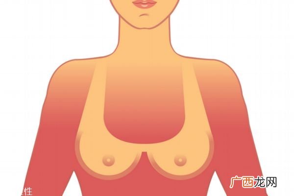 乳房湿疹治疗建议乳头湿疹吃什么好