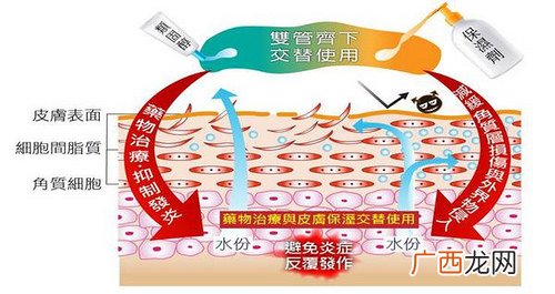 异位性皮炎用什么药保湿