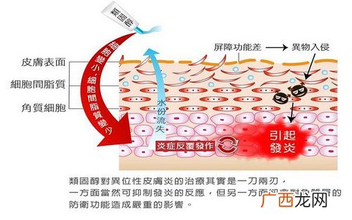 异位性皮炎用什么药保湿
