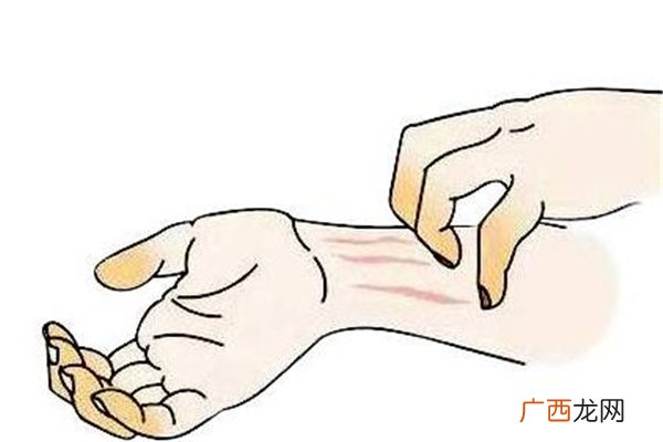 冬季湿疹怎么办预防才是重点