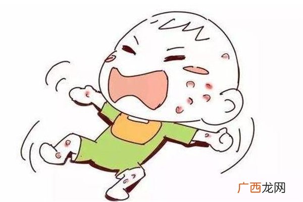 冬季湿疹怎么办预防才是重点