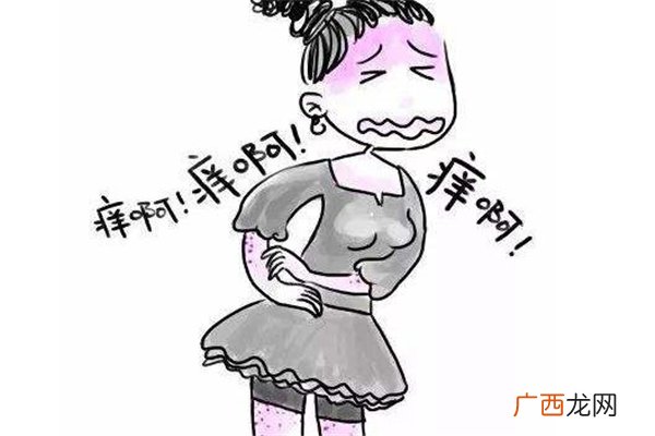 植物日光性皮炎症状与治疗