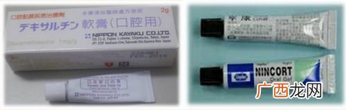 嘴破皮成溃疡了怎么办4招用药防复发