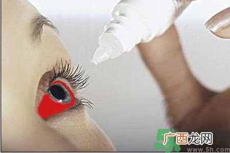 红眼病的表现状态有哪些?红眼病怎么治疗?