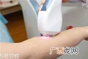脱毛仪可以脱发际线吗？脱了还会再长