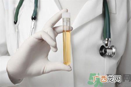 尿蛋白是什么?尿蛋白怎么改善好?