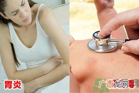 胃炎和肠病毒难分辨?胃炎和肠病毒有什么不同