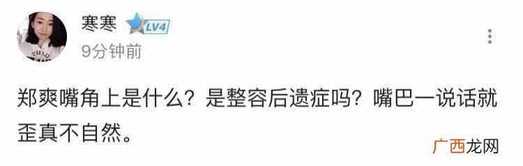 烫伤后黑印多久能消退 怎么去伤疤黑印
