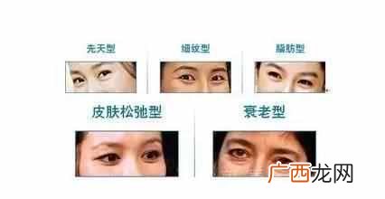 睡醒眼袋肿是什么原因引起的（下眼袋肿了有点