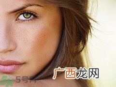 肝斑是肝有问题吗?肝斑怎么调理简单方法