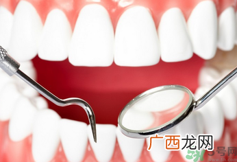 牙齿根管治疗需要多长时间?牙齿根管治疗需要几次?